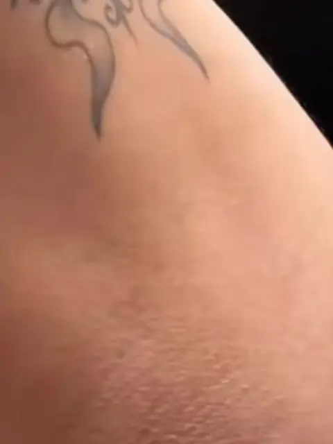 Axila depois do Sérum Clareador Maxfem